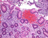 EOSIN B (C.I. 45400) FOR MICROSCOPY CERT